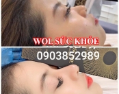 Spa Tiêm Filler Uy Tín Quận 6